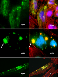 Fluorescence microscopy of DNA Expression in the Human Wild-Type and P239S Mutant Palladin