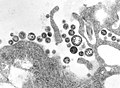 Lassa-virus (Arenaviridae)