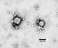 lymphocytic choriomeningitis mammarenavirus (LCMV) (Arenaviridae)