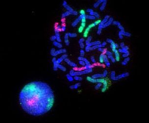 Fluorescence microscopy images of sun flares pathology in a blood cell showing the affected areas in red