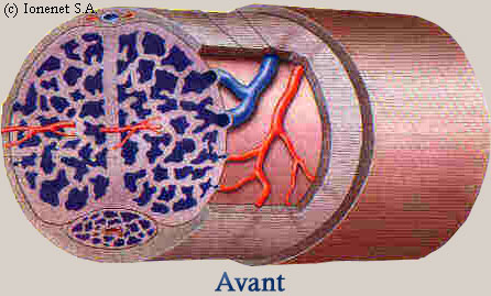 Cavit�s des corps caverneux et spongieux dans leur �tat initial, avant tout programme d'agrandissement du p�nis.