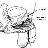 Le ligament suspenseur plus dans le d�tail