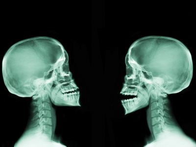 x-ray image of two human skulls facing each other