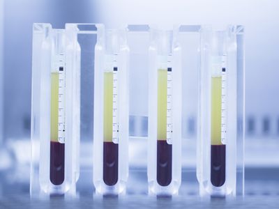 Insulin separated from blood in container