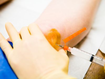 Knee Cortisone Injection 