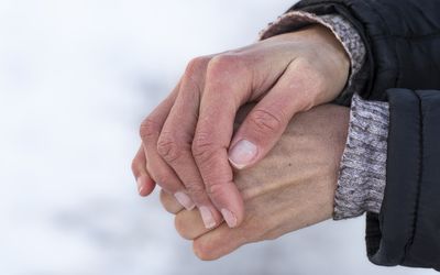 Women's hands with dry damaged skin in winter