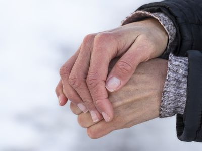 Women's hands with dry damaged skin in winter