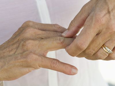 Senior woman rubbing knuckles