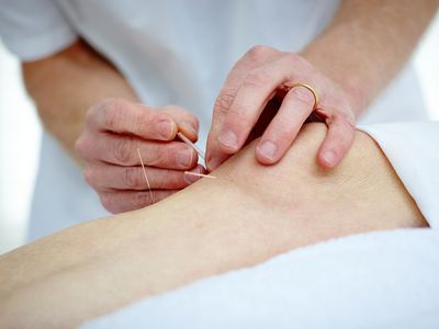 knee acupuncture