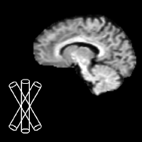 @brain-microstructure-exploration-tools