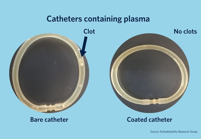 Image: Catheters coated with the new material showed a significant reduction in clotting on the device surface (Photo courtesy of UBC Faculty of Medicine)