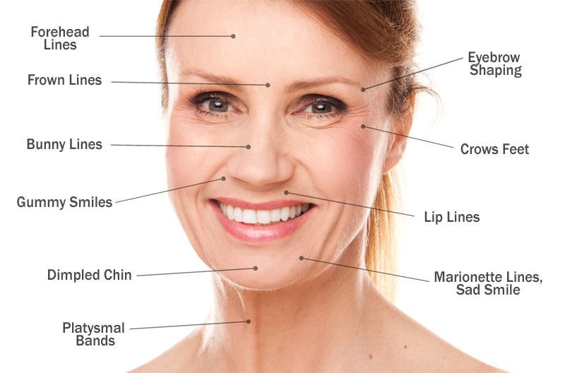 facial rejuvination, botox, filler, fine lines, wrinkles, beauty lines, crows feet, frown lines, fam